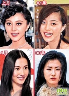 盘点 谁敢说这些明星没整过容？沒整過我會八嗎？